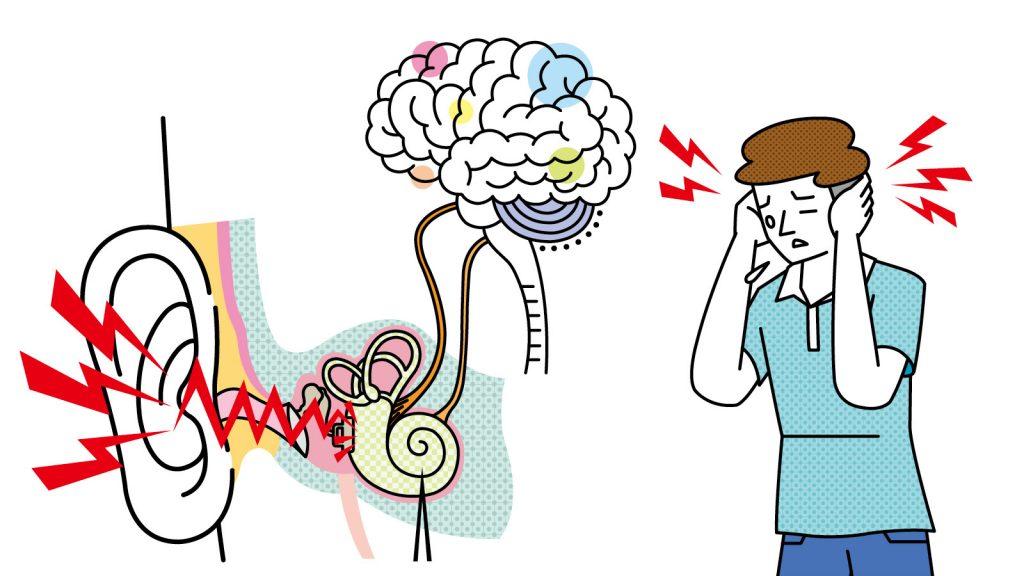 【加齢のトリセツ】気のせい？ ストレスによる一過性？不快な耳鳴りが生活の質を下げる