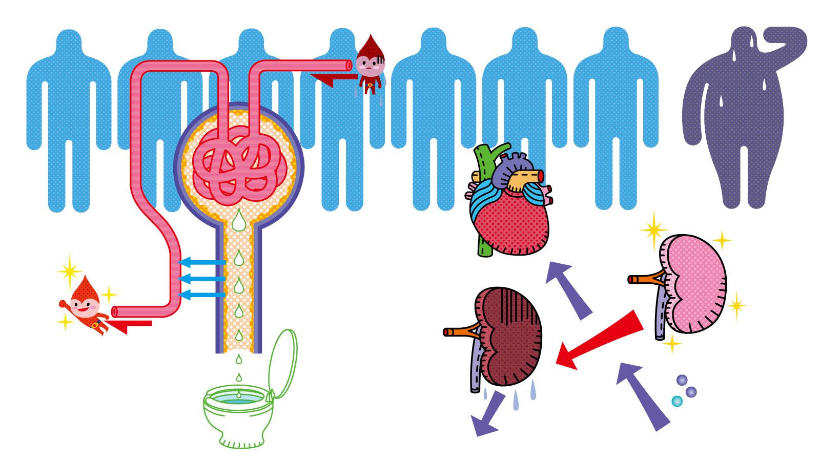 実は隠れた国民病か。慢性腎臓病（CKD）をしっかり学ぶ