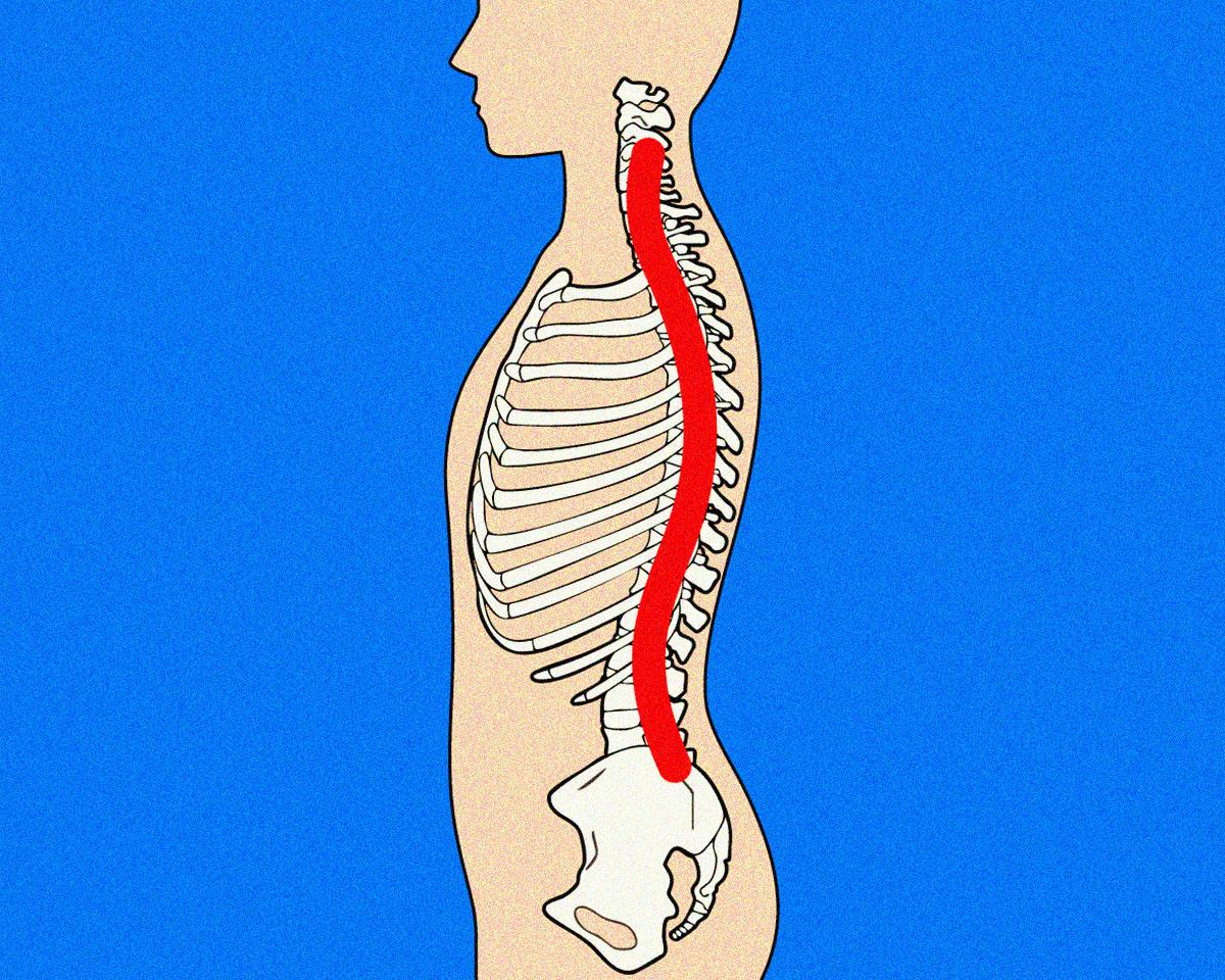 猫背・首こり・腰痛の元凶！背骨のC字化を防ぐには？