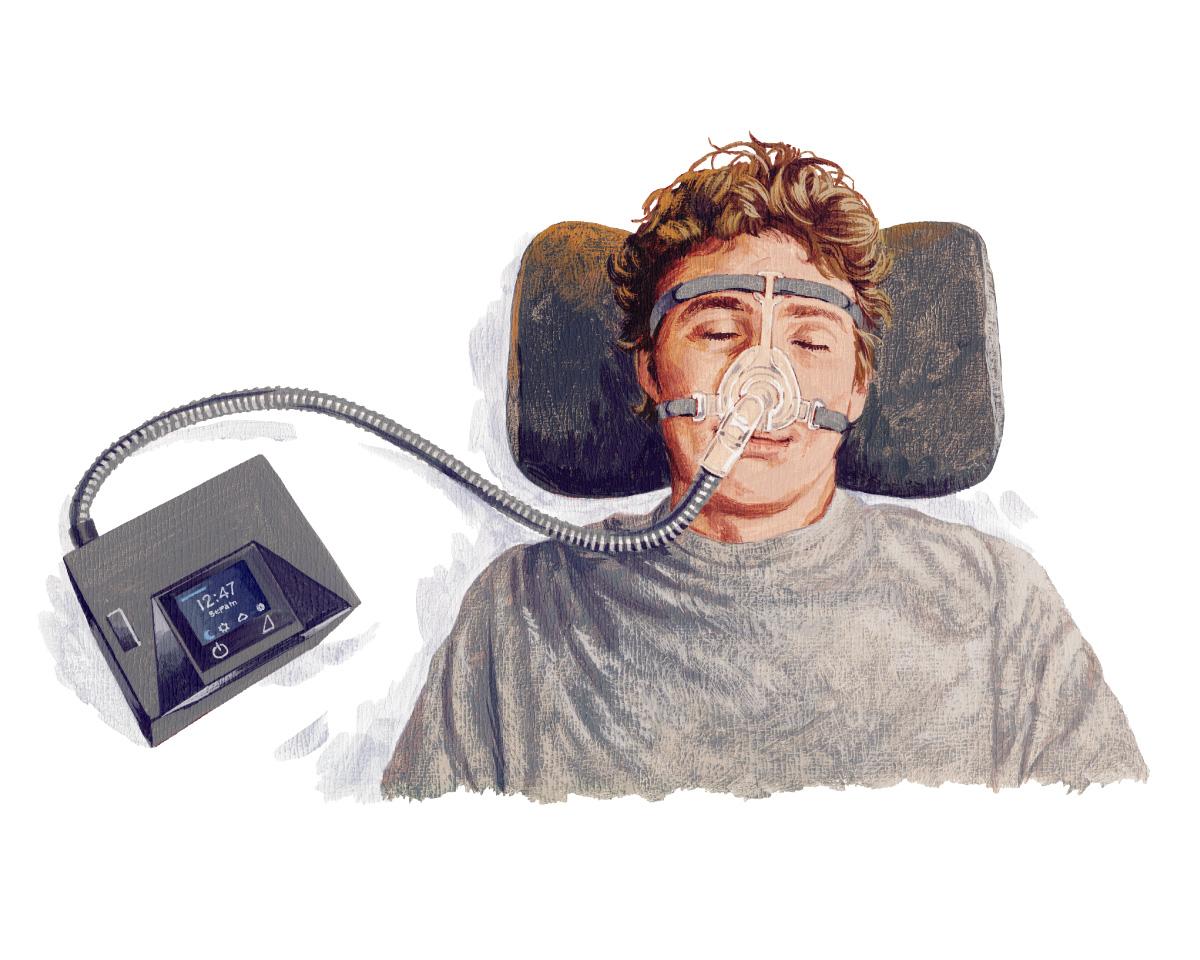 日中のパフォーマンスも改善。人類の睡眠を救う、CPAPとは?